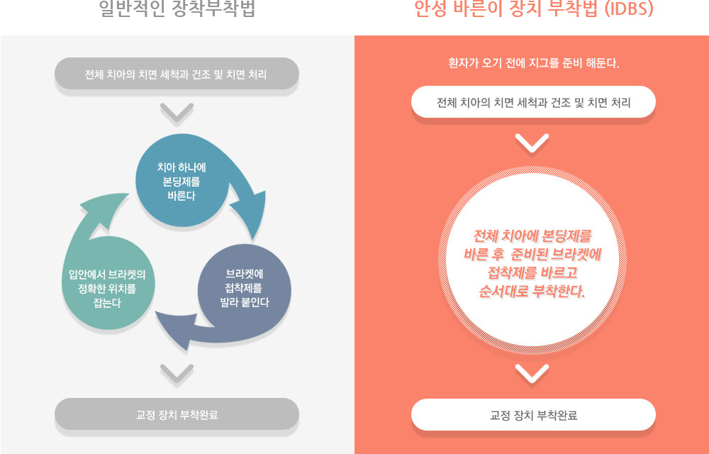 안성바른이 장치부착법